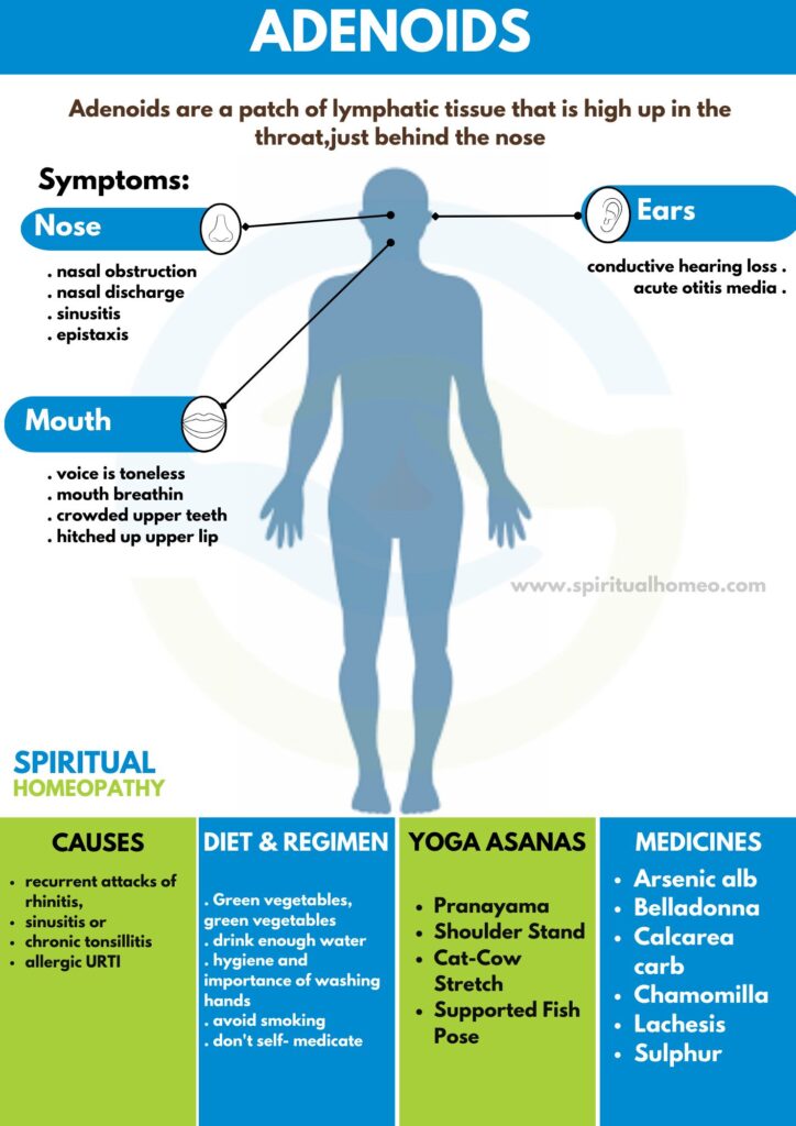 Best Homeopathy Treatment for Adenoids | Expert Care