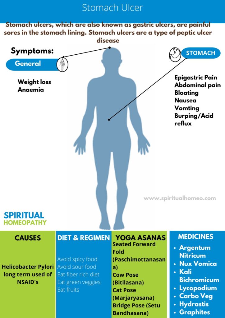 Effective Homeopathic Treatment for Stomach Ulcer | Expert Doctor