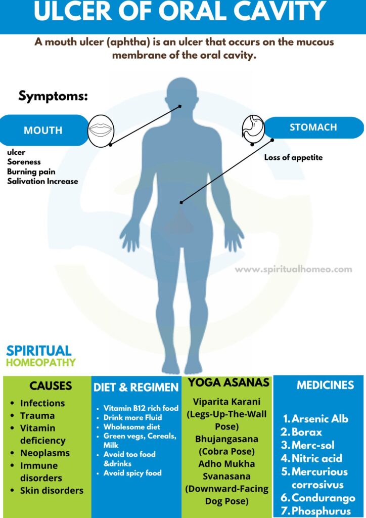 Best Effective Homeopathic Treatment for Mouth Ulcer
