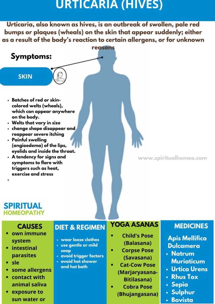 Best Homeopathy Doctor for Urticaria in Hyderabad