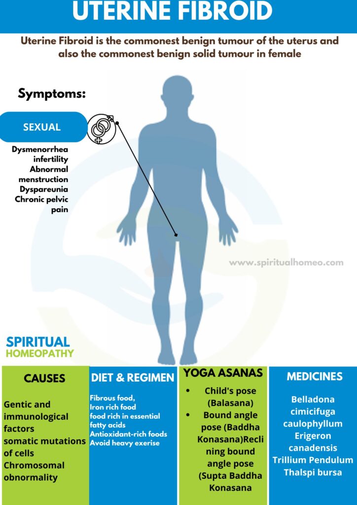 Best Homeopathic Treatment for Uterine Fibroid