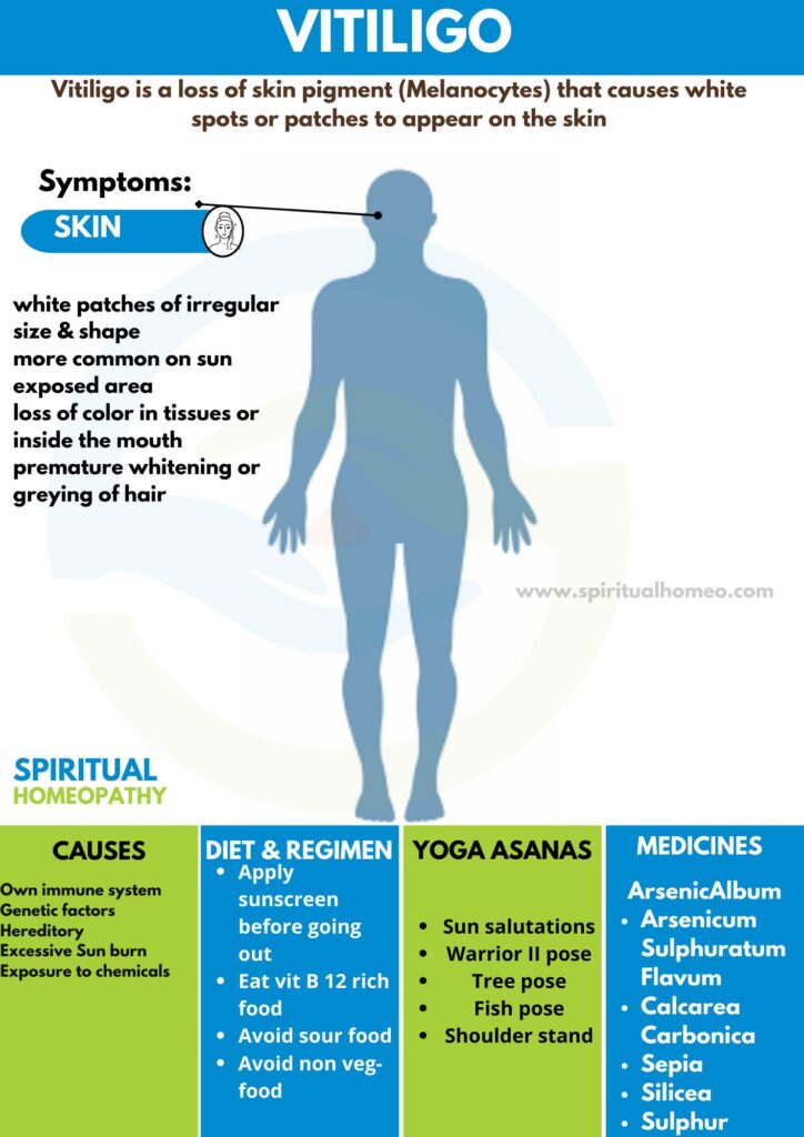Best Homeopathy Treatment for Vitiligo in Hyderabad