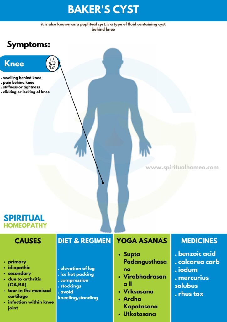 Best Homeopathy Doctor for Baker’s Cyst in Hyderabad