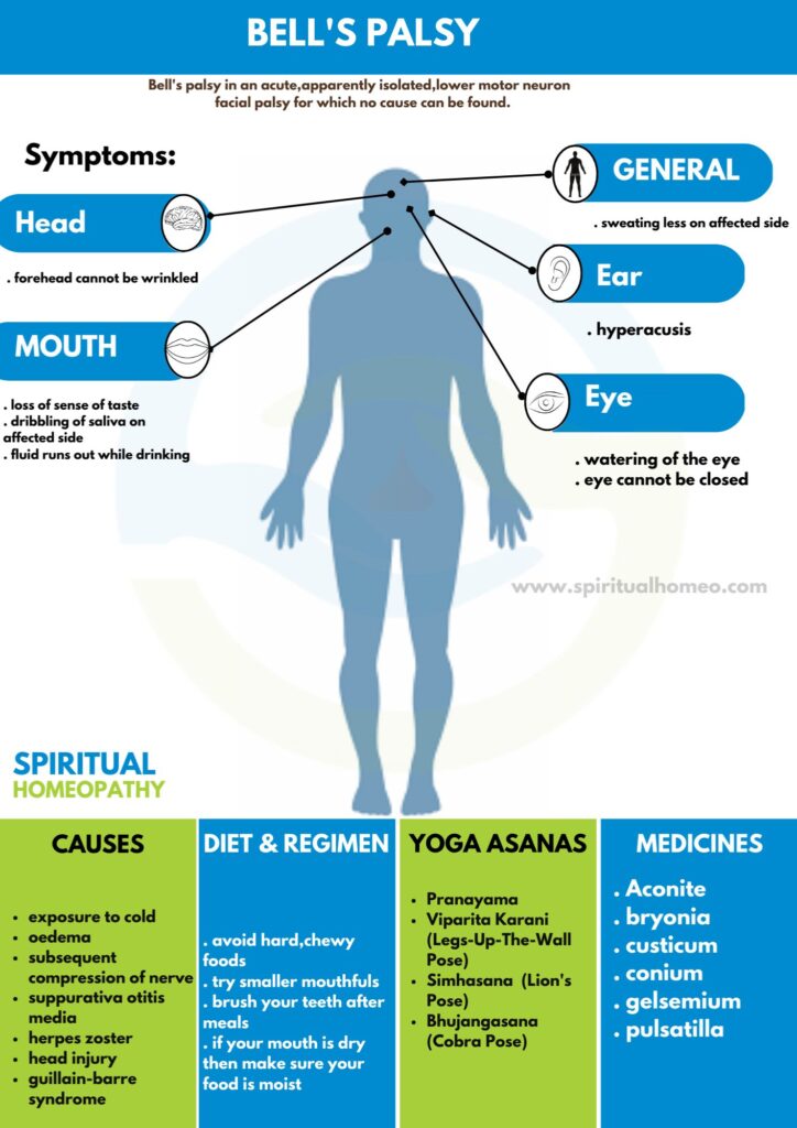 Best Homeopathy Doctor for Bell’s Palsy in Hyderabad