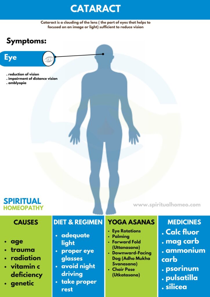 Homeopaty treatment for cataract