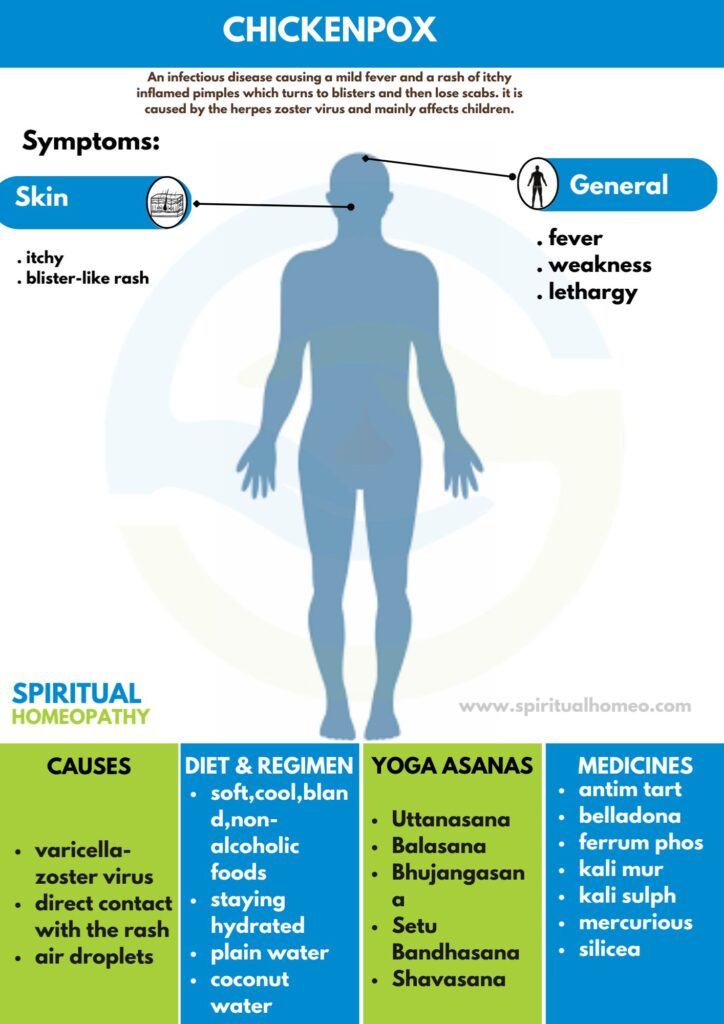 Best Homeopathy Treatment for Chicken Pox | Hyderabad