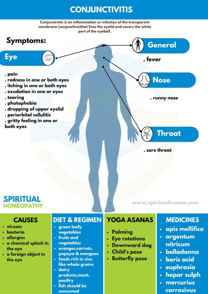 Best Homeopathy Doctor for Conjunctivitis in Hyderabad