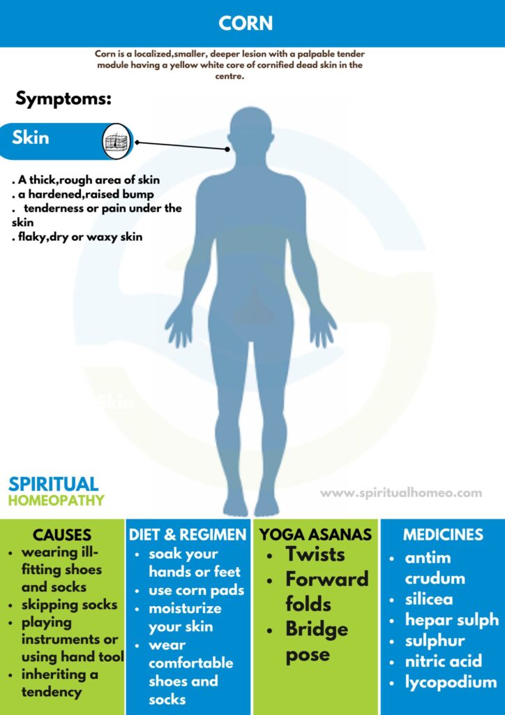 Best Homeopathy Doctor for Corn in Hyderabad