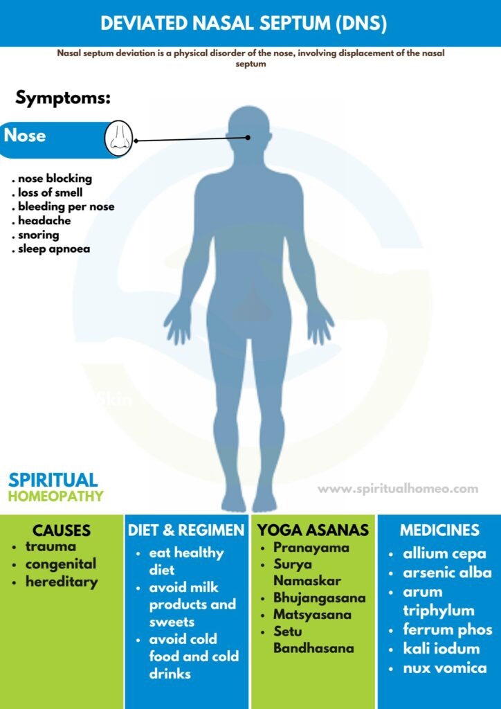 Homeopathy treatment for Deviated Nasal Septum [DNS]