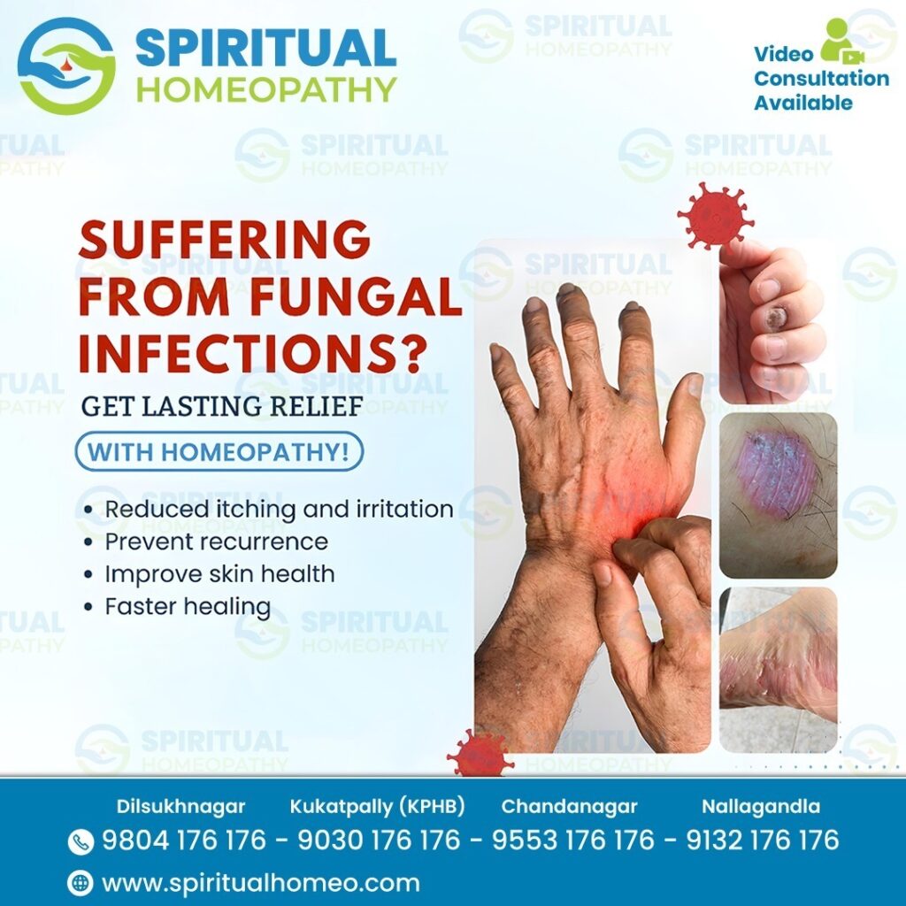 Fungal Infection Causes, Symptoms, and Treatment Guide