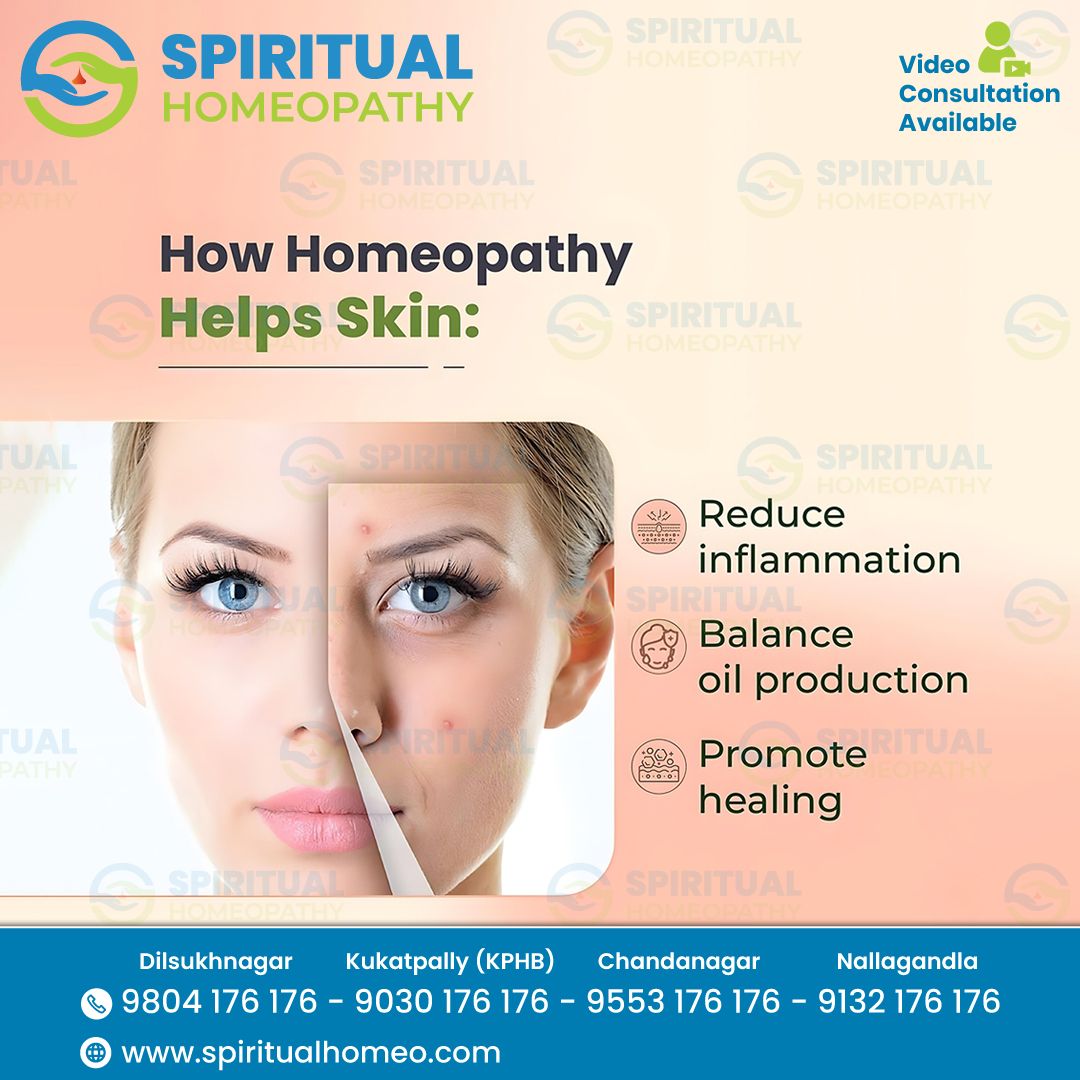 Achieve Healthy Skin Naturally: Consult the Best Homeopathy Doctors in Hyderabad