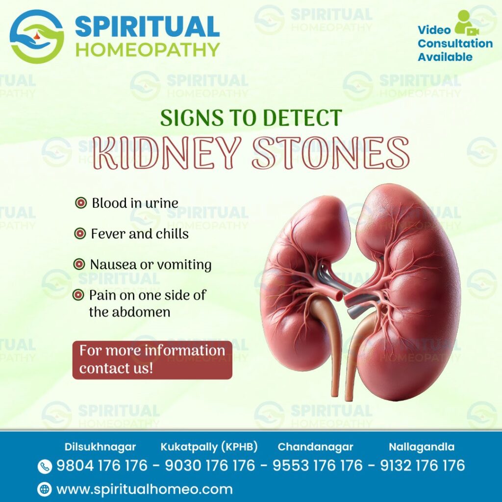 Kidney Stones: Causes, Symptoms, and Effective Relief Tips