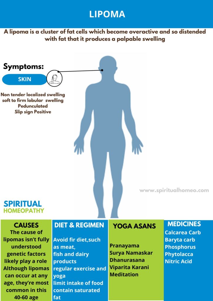 Best Homeopathic Treatment for Lipoma in Hyderabad