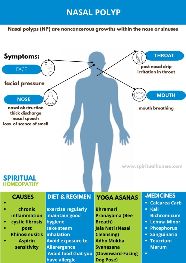 Effective Homeopathic Treatment for Nasal Polyp – Top Doctor
