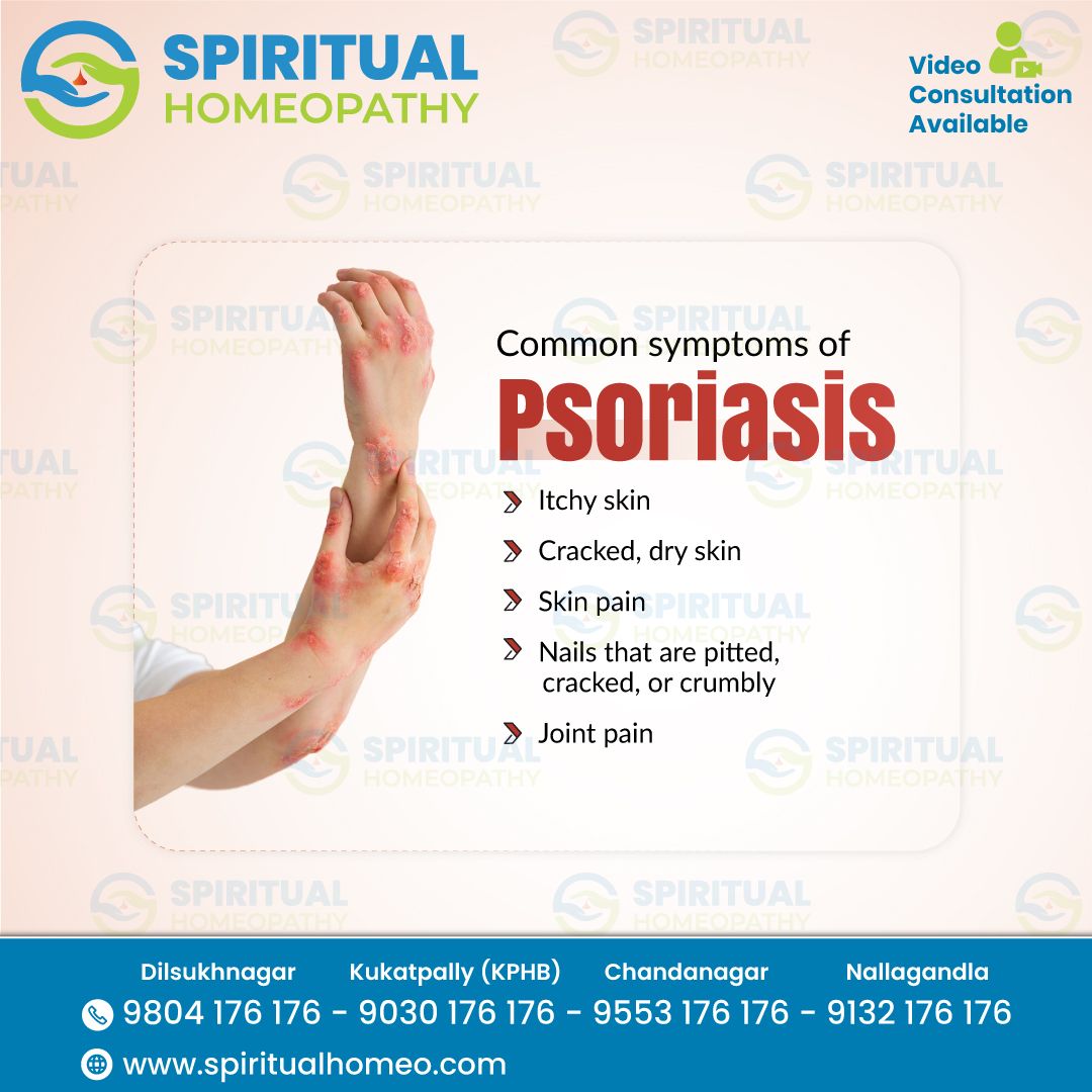 Understanding Psoriasis and How Homeopathy Can Help: Consult the Best Homeopathy Doctors in Hyderabad