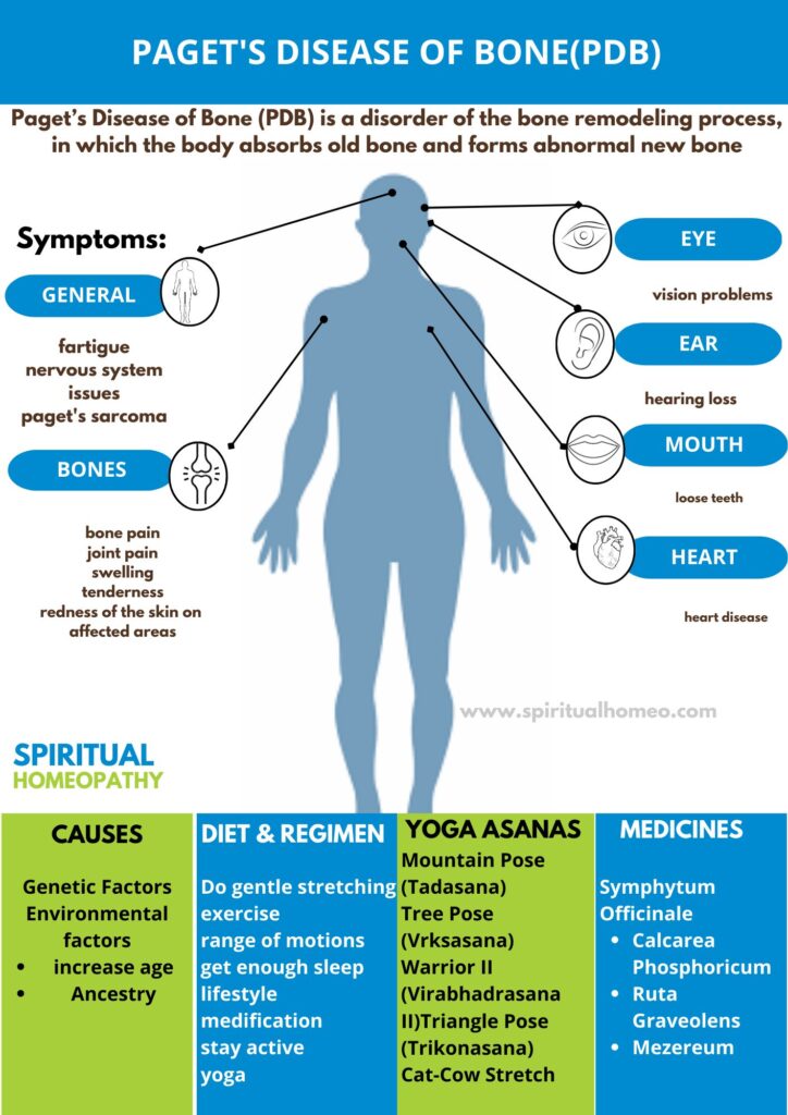 Best Homeopathic Doctor for Paget’s Disease | Hyderabad