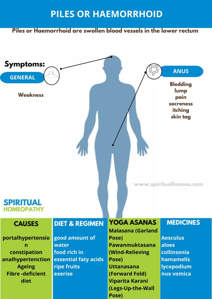 piles and haemorrhoid