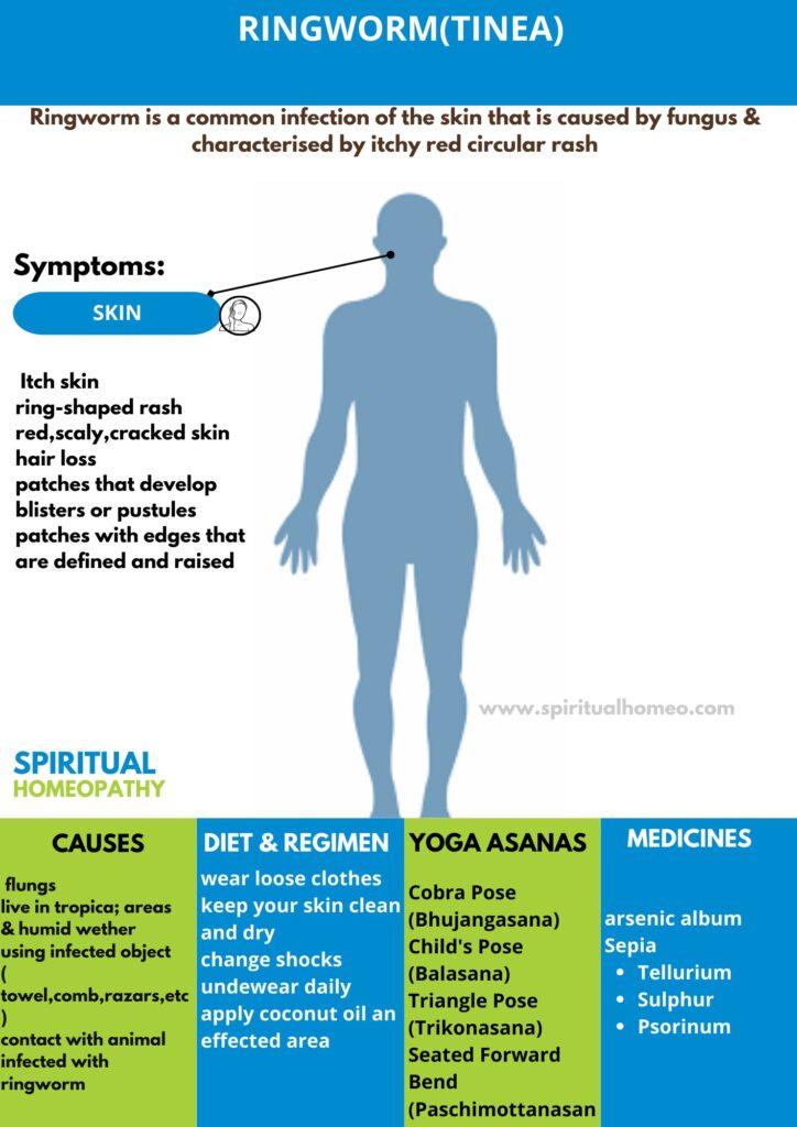 Best Homeopathy Treatment for Ringworm in Hyderabad