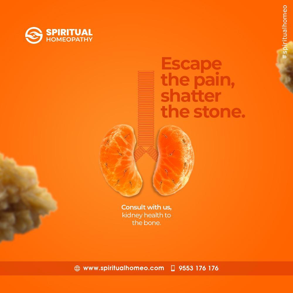 Online Homeopathy Consultation in India: Treat Kidney Stones from Home