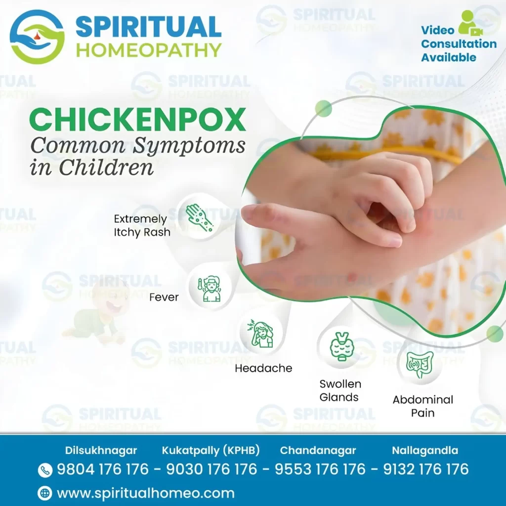 chicken_pox_children