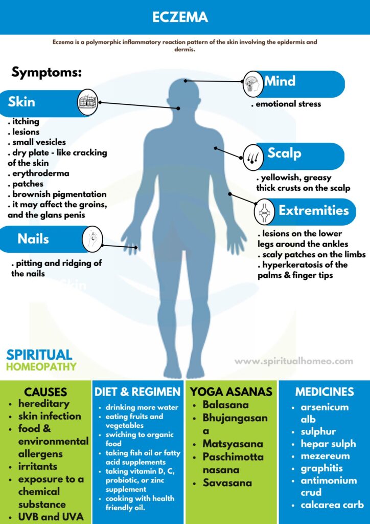 Best Homeopathic Treatment for Eczema in Hyderabad