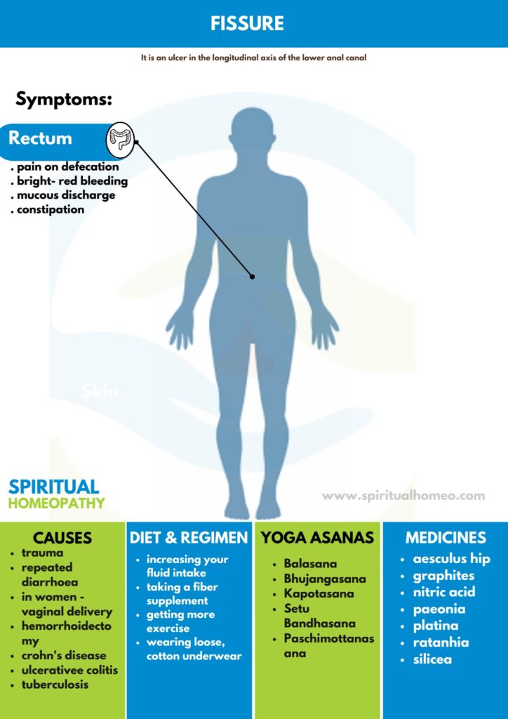 Homeopathy treatment for fissure by expert doctors in Dilsukhnagar, Kukatpally, Chanda Nagar & Nallagandla. Trusted, safe & affordable care for fissures.