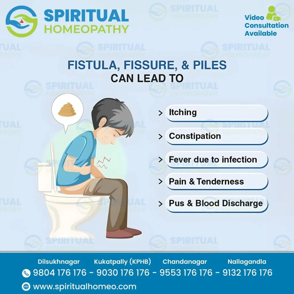 fistula_fissure_piles