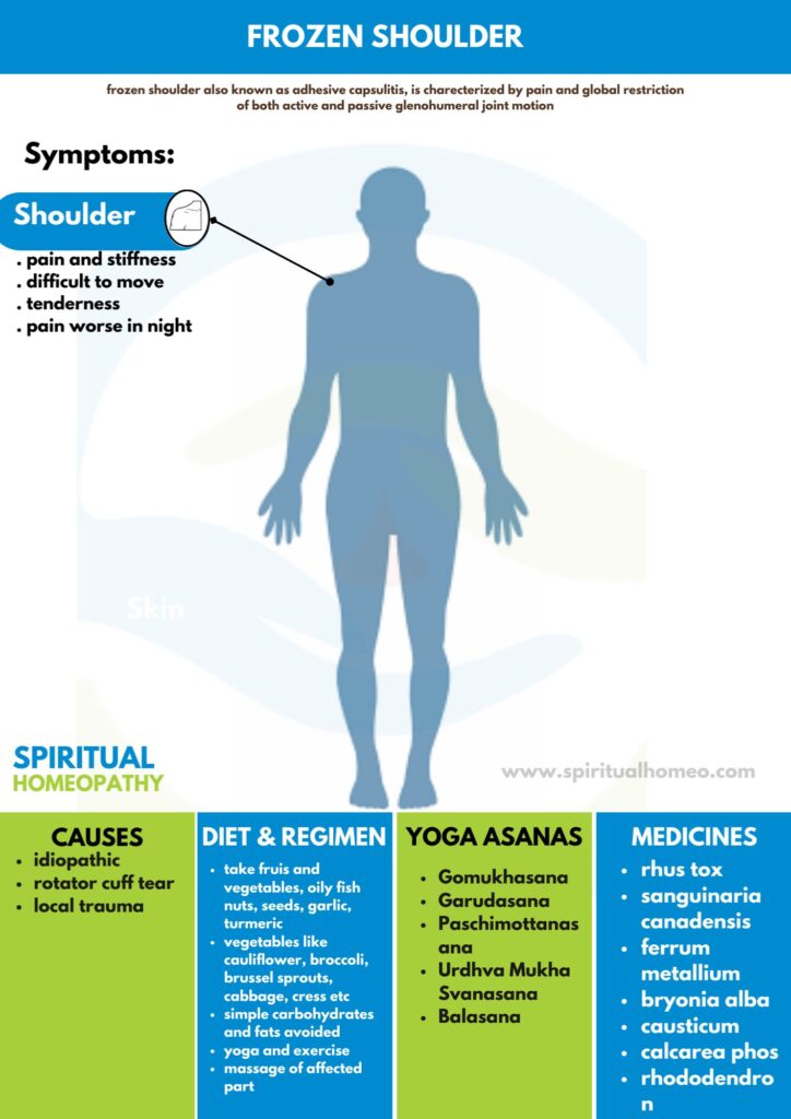 Best Homeopathy Doctor for Frozen Shoulder Care