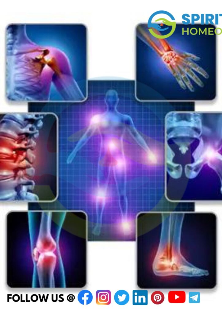 Effective Homeopathic Treatment for Musculoskeletal pain by expert, trusted doctors in Dilsukhnagar, Kukatpally, Chanda Nagar & Nallagandla.
