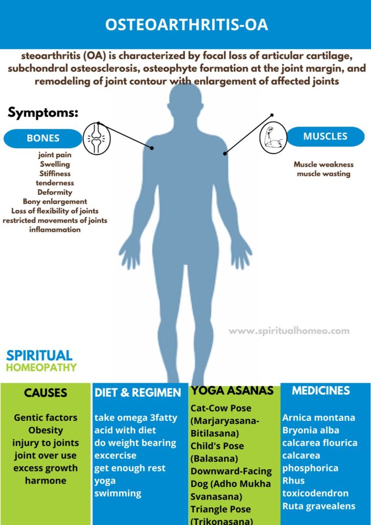 Best Homeopathic Treatment for Osteoarthritis OA