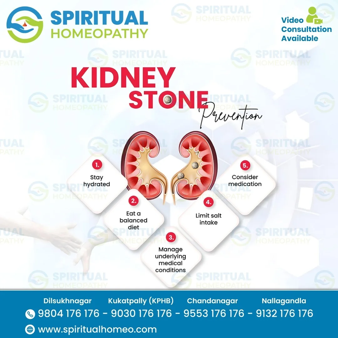 Kidney Stone