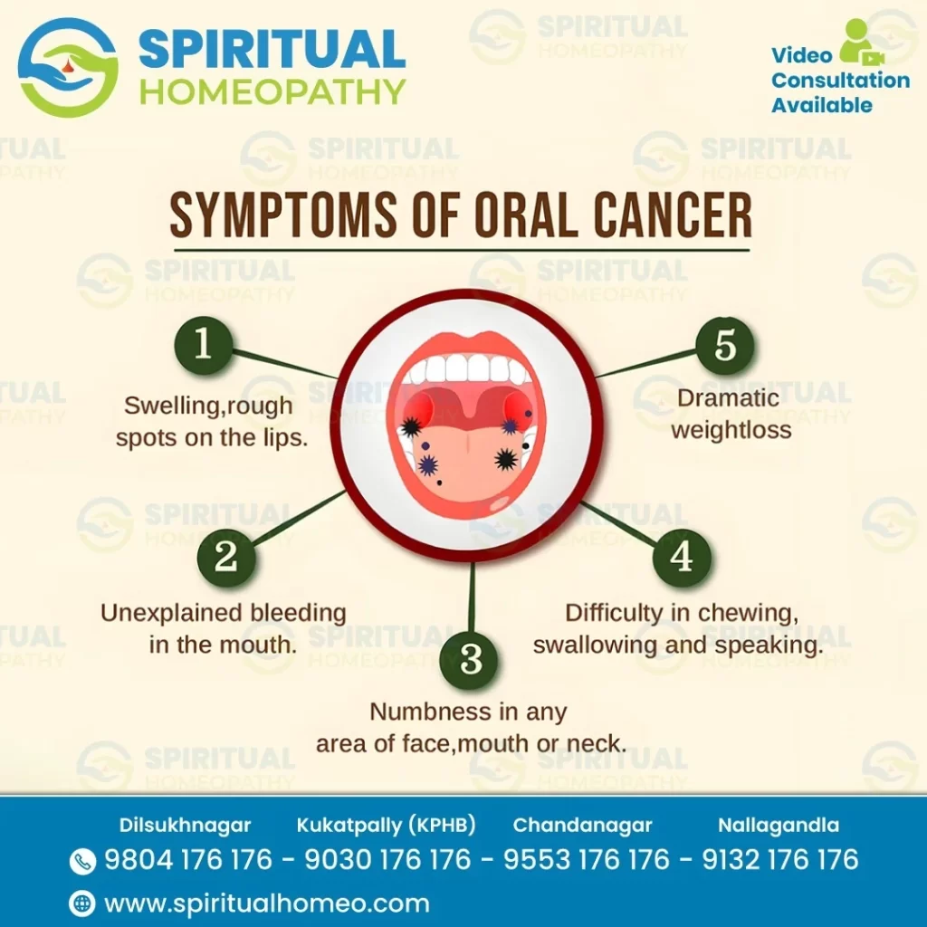 oral cancer