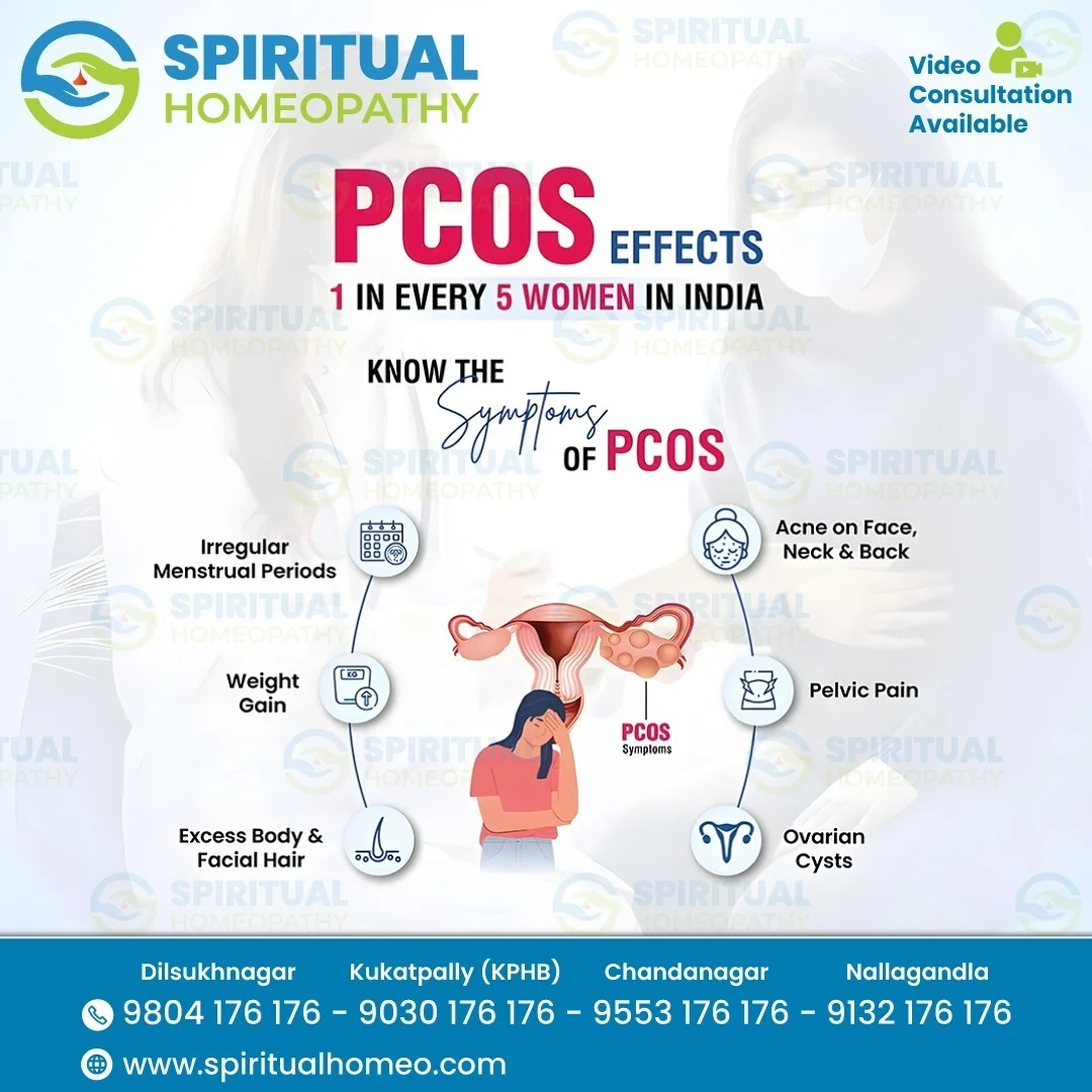 pcos symptoms