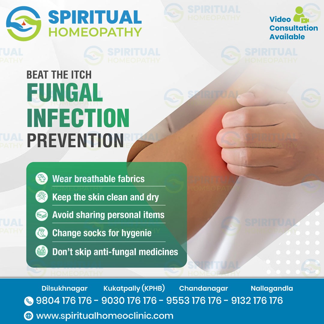 Fungal Infections: Causes, Symptoms, and Treatment