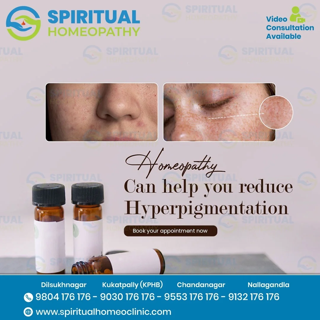 Hyperpigmentation