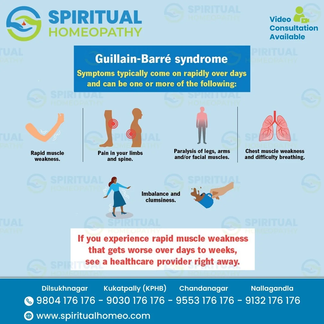 guilian barre syndrome