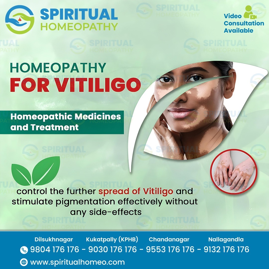 Understanding Vitiligo: Causes, Symptoms, and Treatment