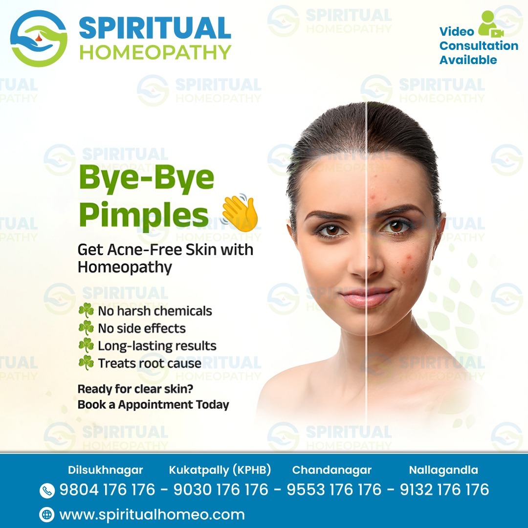 Safe Homeopathy Treatment for Effect of Bye Bye Pimple | Dilsuknagar Hyderabad