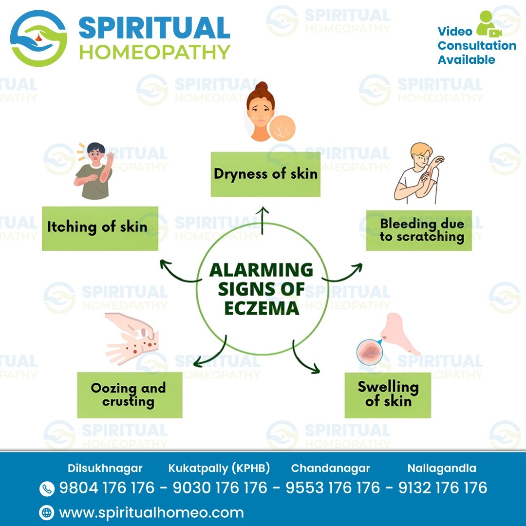 Best Homeopathy Treatment for Effect of Eczema Near You | Kukatpally Hyderabad