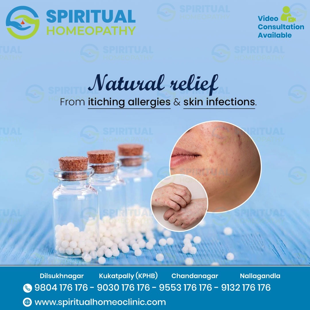 Homeopathy Treatment for Itching Skin Allergy in Nallagandla Hyderabad
