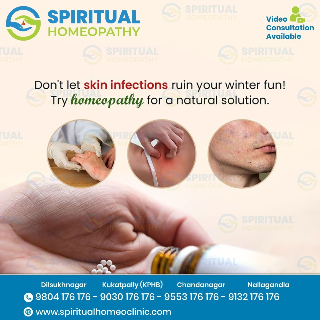 Holistic Homeopathy Treatment for Skin Infections in Kukatpally