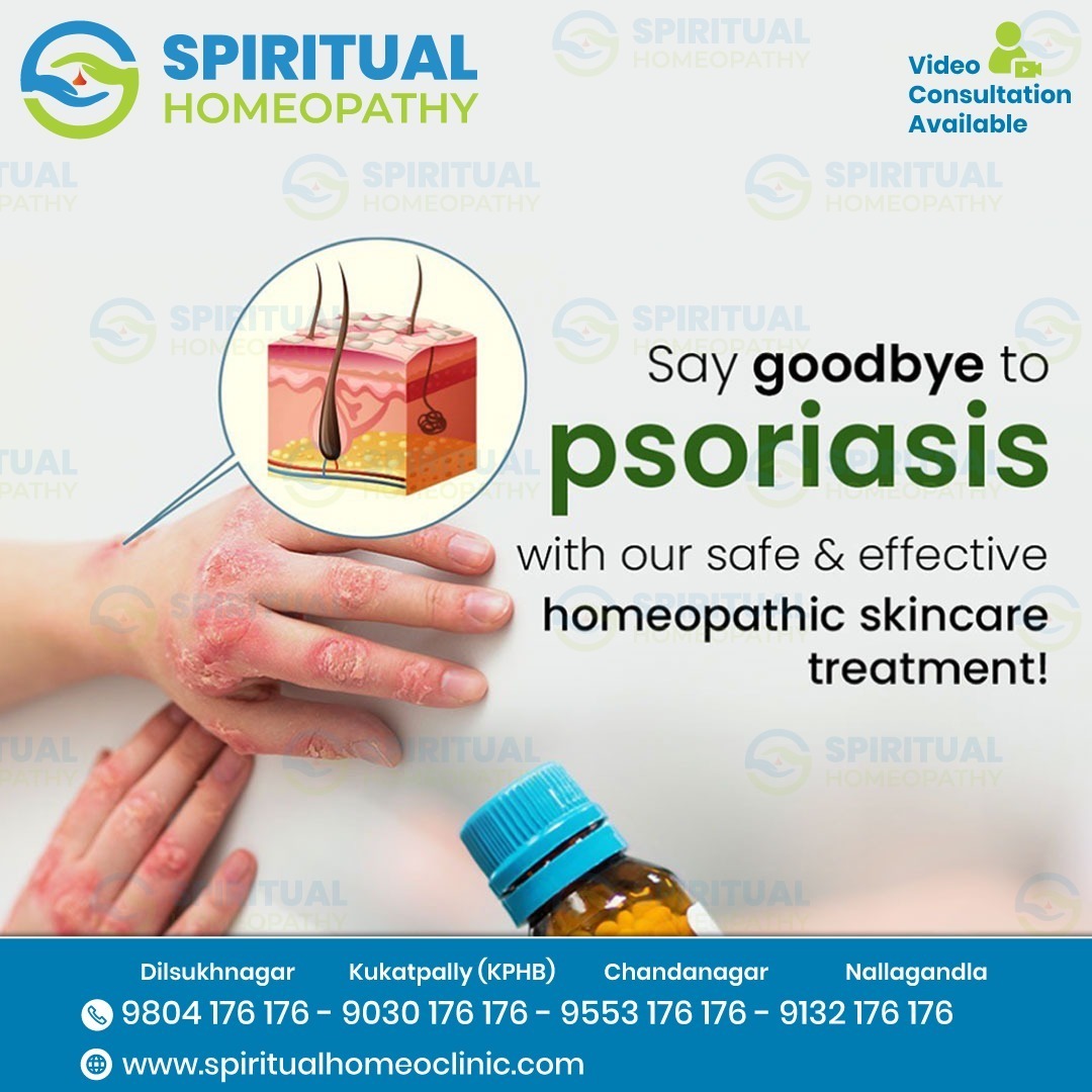 Natural Psoriasis Care with Homeopathy Doctor in Dilshuknagar