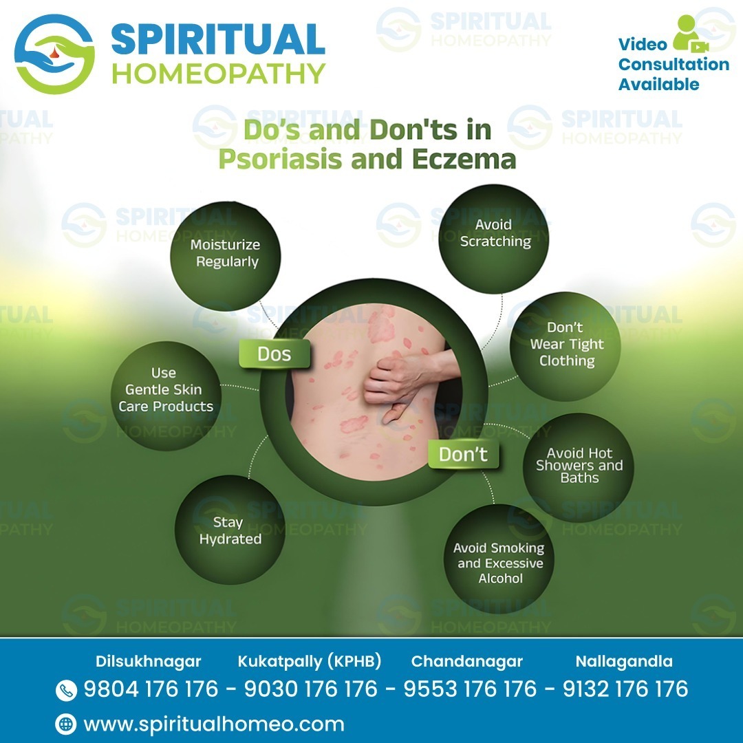 Psoriasis & Eczema Care at Homeopathy Clinic in KPHB
