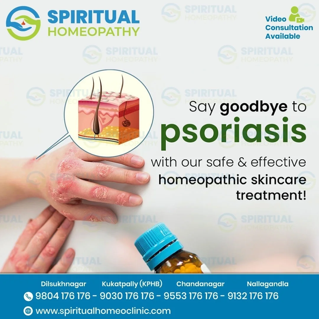psoriasis