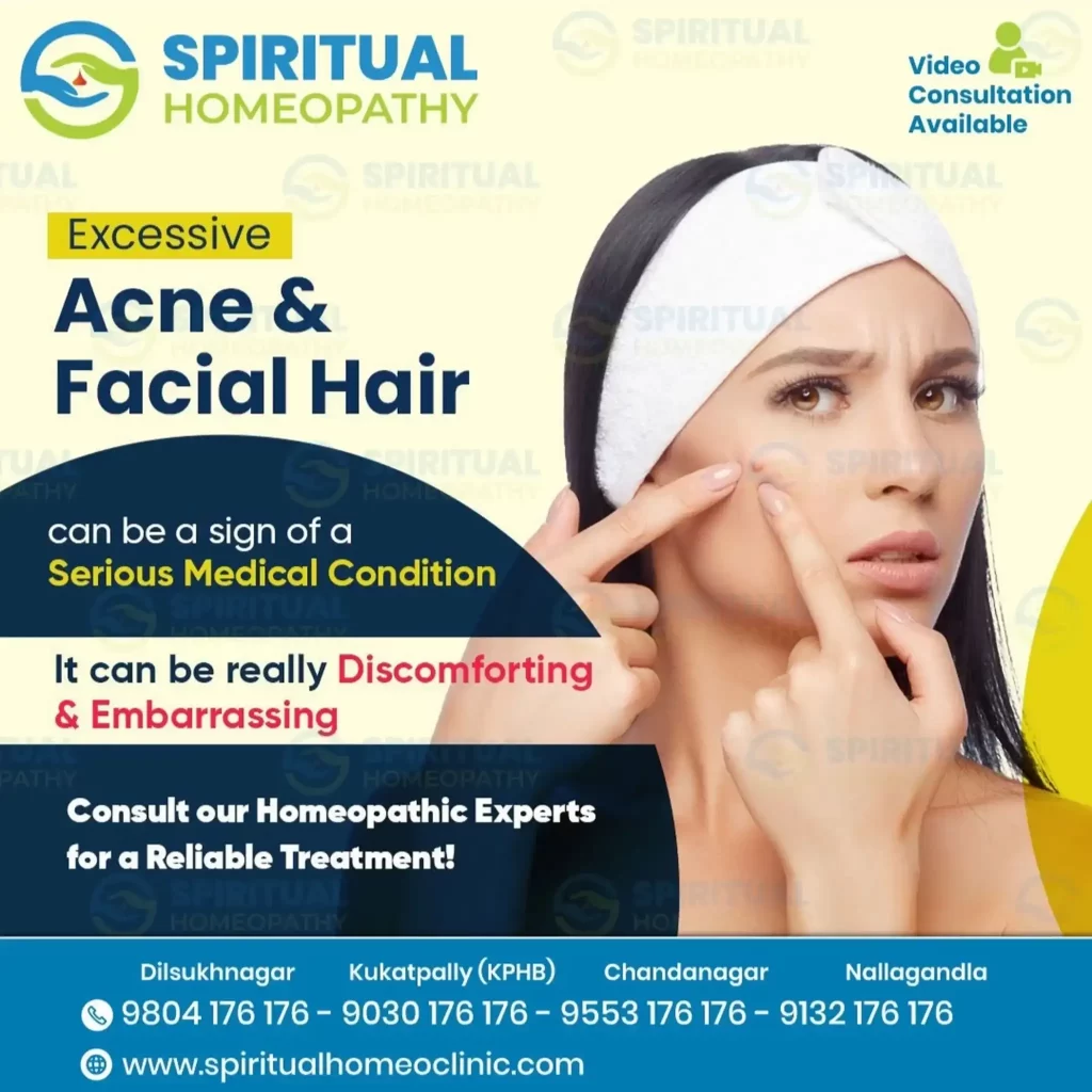 acne facial hair