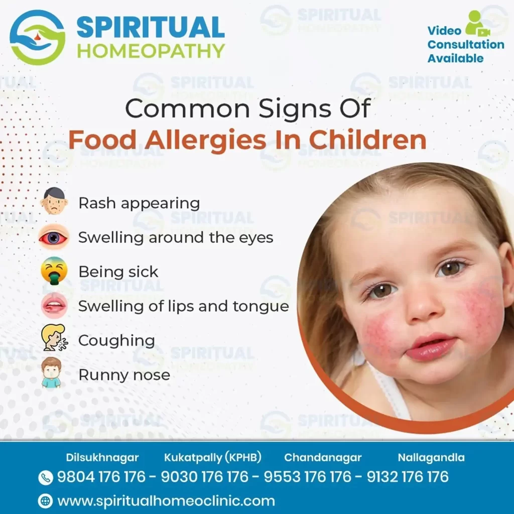 food allergy children