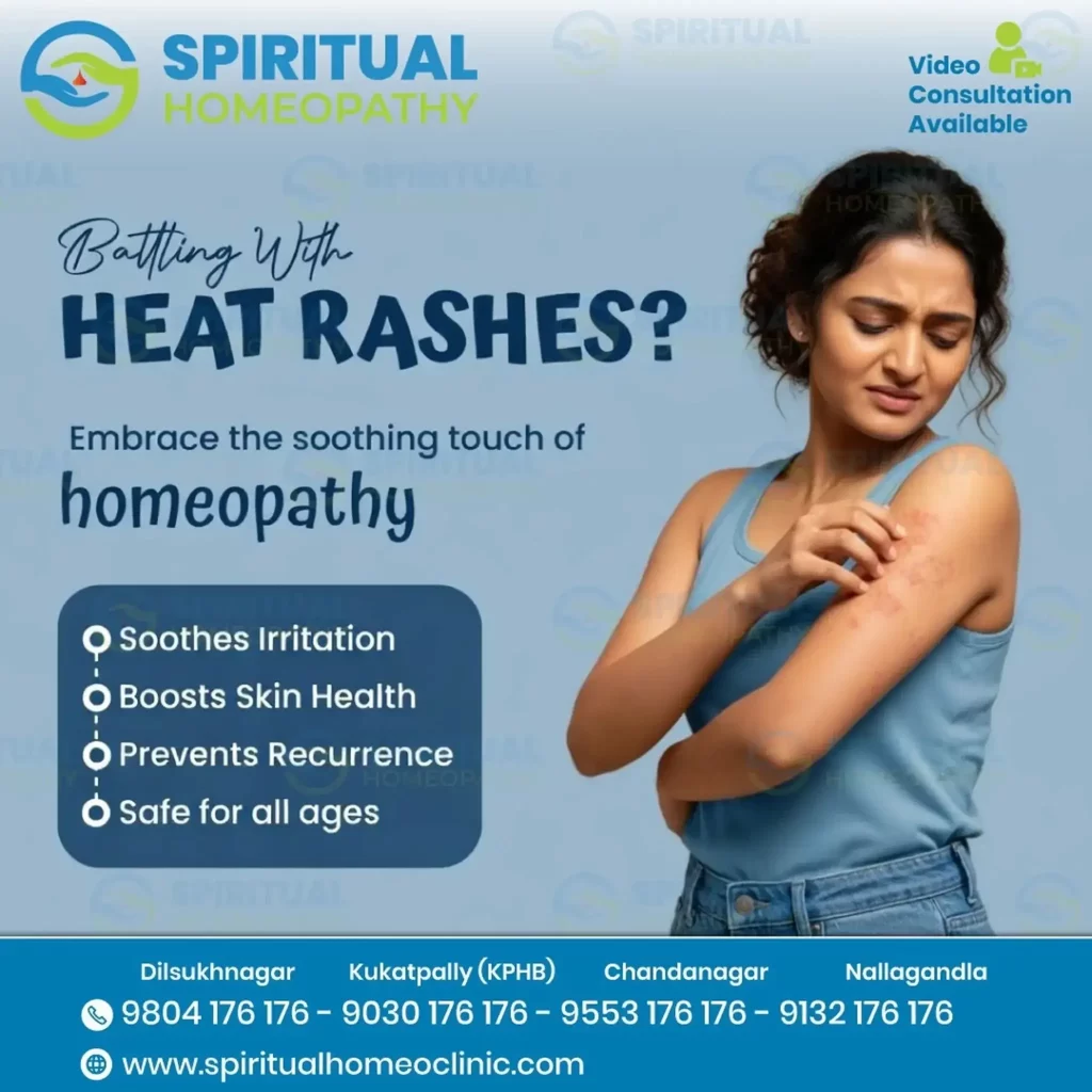 heat rash