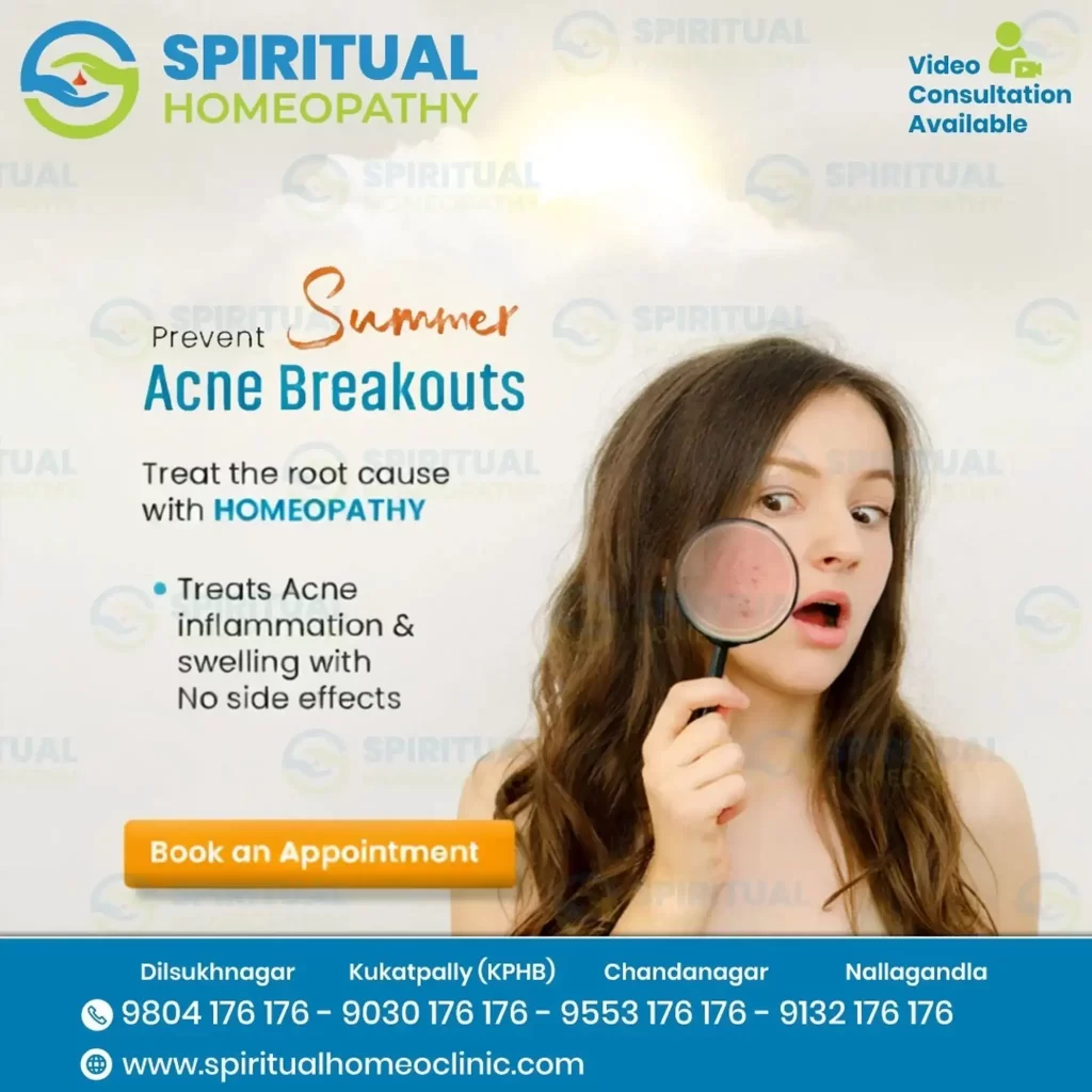 summer acne breakouts