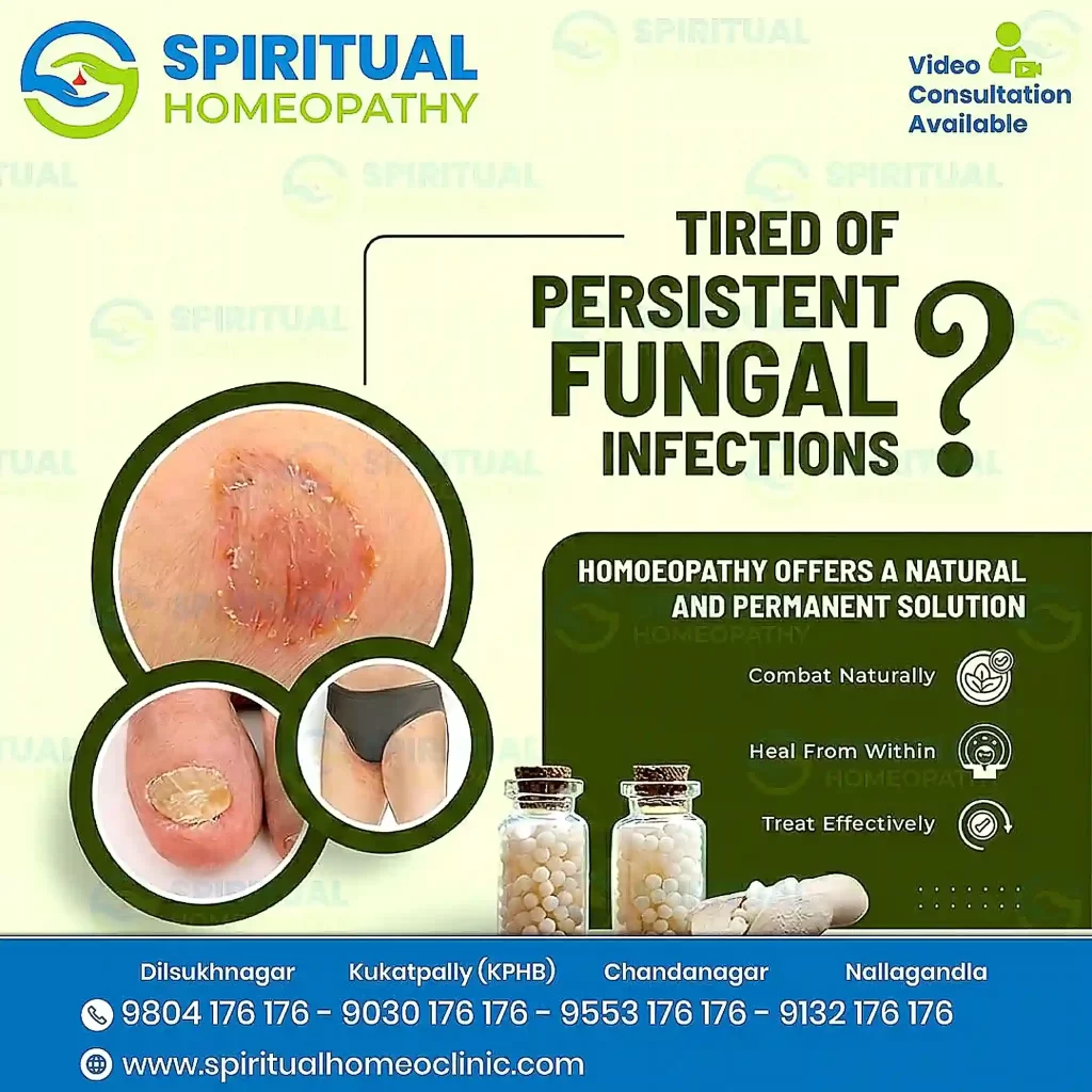 fungal infection