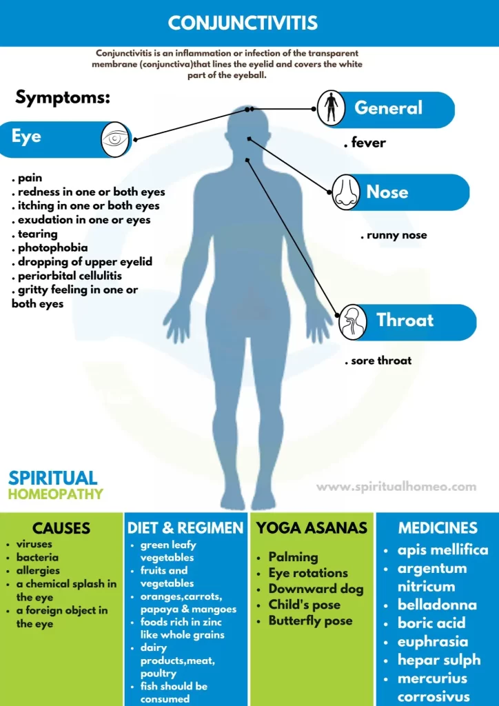 Conjunctivitis